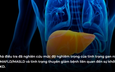 Nguy cơ mắc CKD tăng lên khi mắc một số bệnh về gan